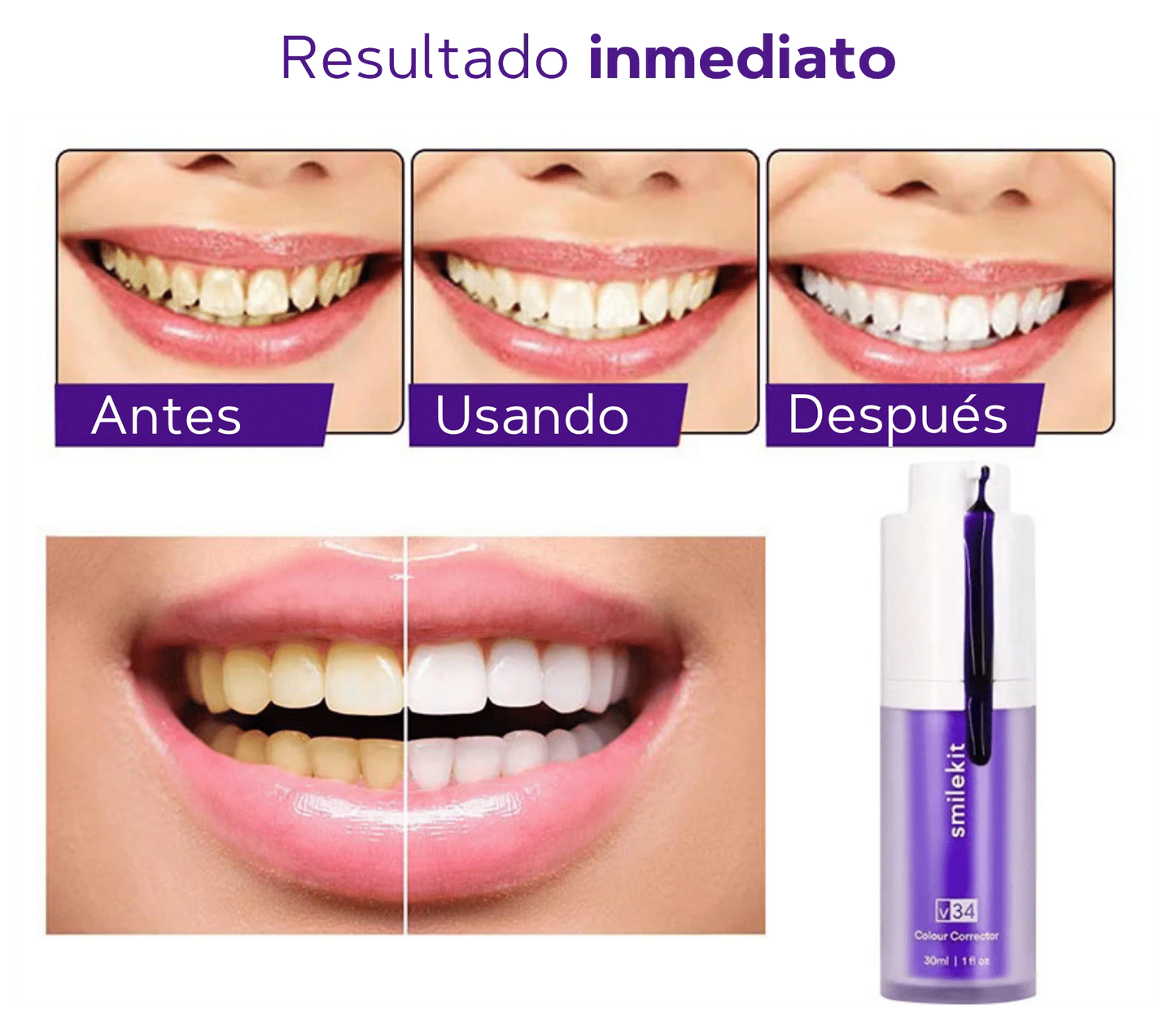 SmileKit® Crema morada blanqueadora