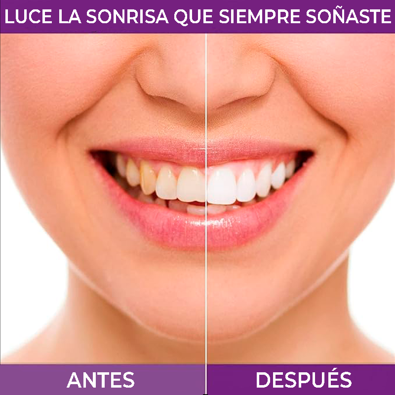 SmileKit® Crema morada blanqueadora